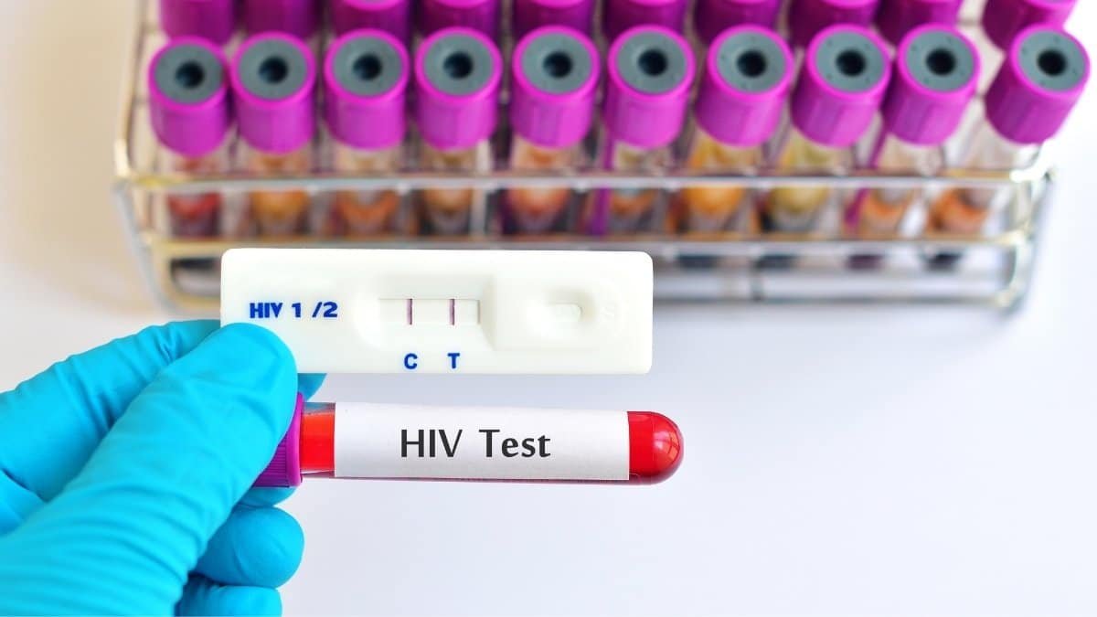HIV testing kit for diagnoses